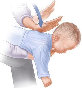《邱柏鈞醫師》幼兒吞食異物的急救