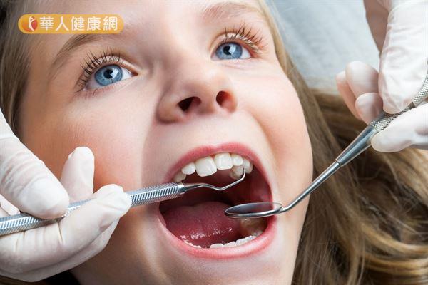 通常会逐渐改善,但是若混合齿列后期的上颚门牙间缝隙仍超过3公厘