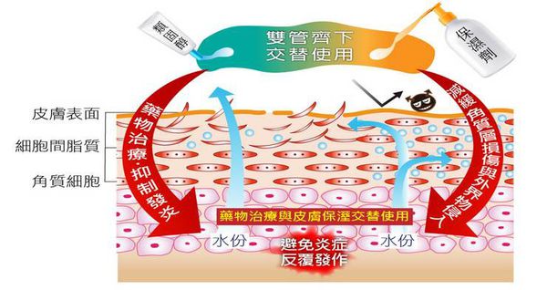 異位性皮膚炎猛擦藥沒效，洗澡後才是重點！