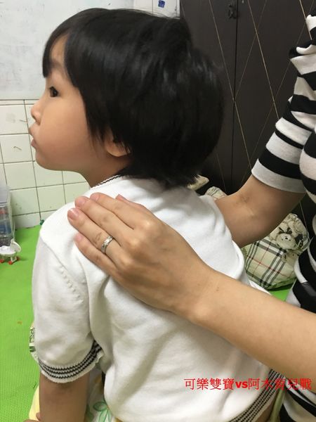 感冒咳嗽痰很多?快學學居家拍痰法