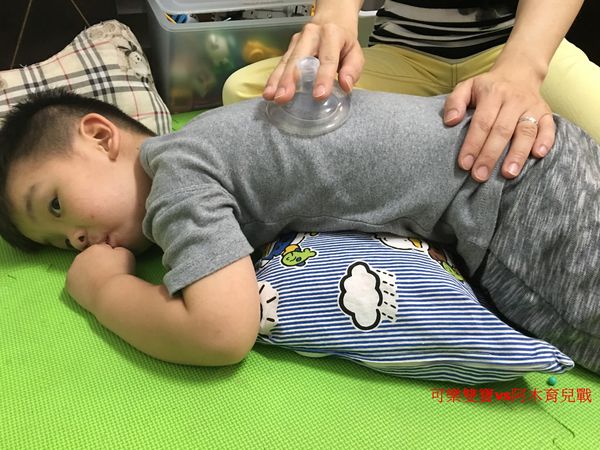感冒咳嗽痰很多?快學學居家拍痰法
