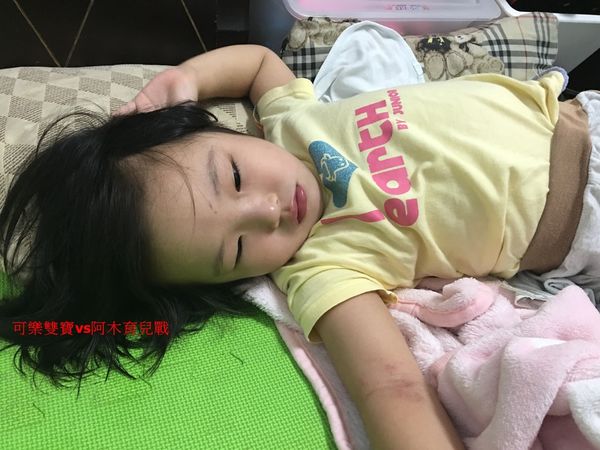 小孩腸病毒爸媽別慌，把握三多居家護理原則