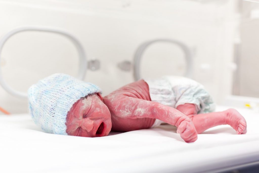 認識「胎脂」，寶寶最天然的肌膚保護層！