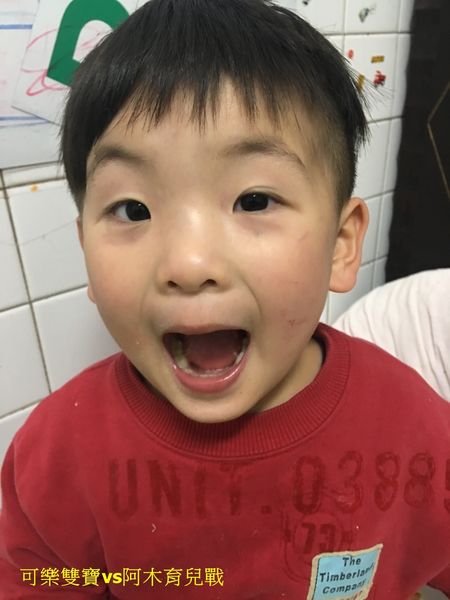 小孩2歲不會說話有問題？常見語言遲緩原因