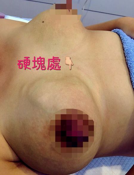 塞奶剋星~小白點