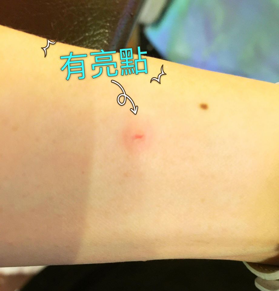 女星曬咬痕笑稱被家暴,磨牙棒DIY度過寶寶口慾期