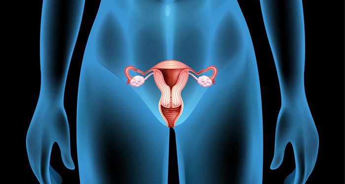 「多囊性卵巢症」是什麼？可以根治嗎？
