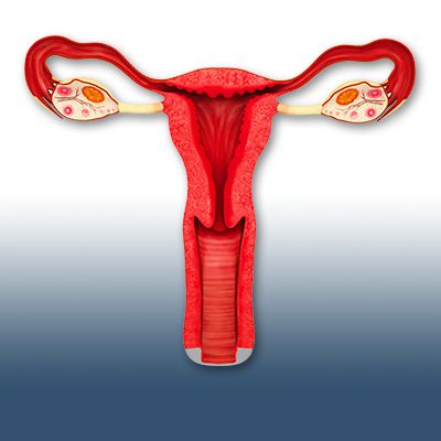 卵巢水瘤該怎麼辦？婦產科醫師告訴妳
