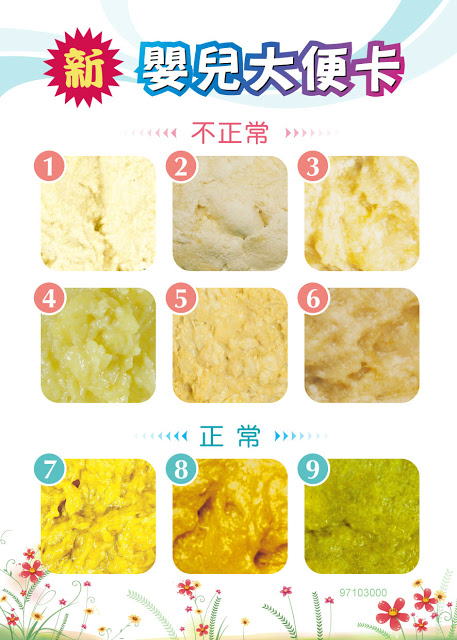 寶寶「屎」壞?爸媽勞記四重點一叮嚀