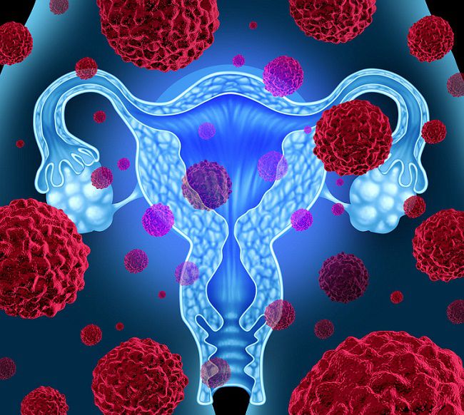 國健署擬全面補助子宮頸癌疫苗，有性經驗也可以？