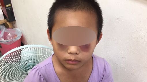 女童遭性虐待,網連署性侵、傷害兒童者加罰鞭刑