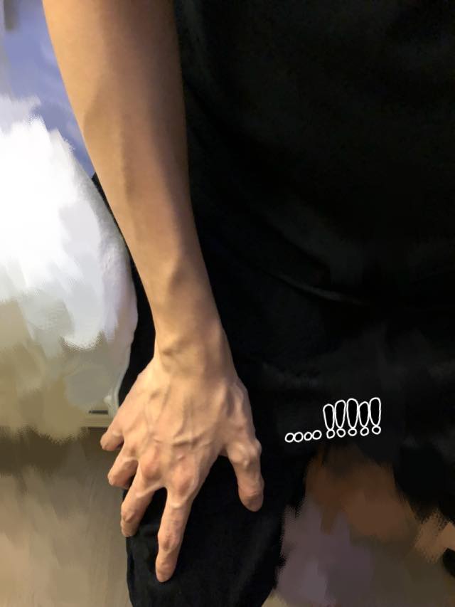 嚴立婷憂早產臥床安胎,滿手爆青筋自嘲男人手