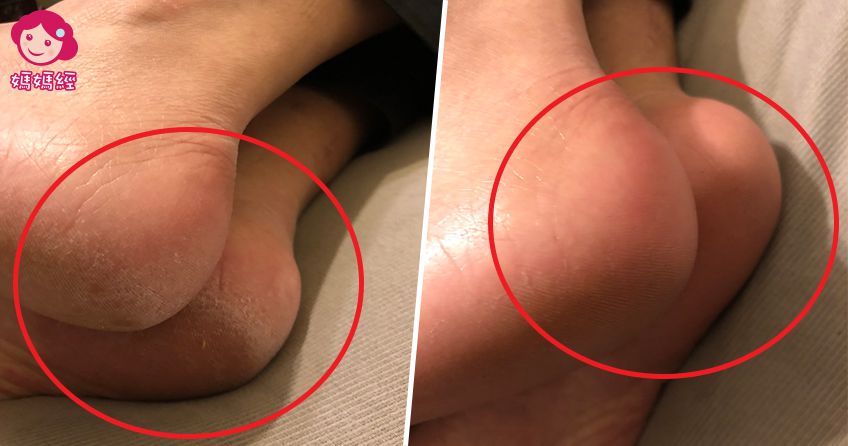 告別換季癢！瓶瓶罐罐斷捨離