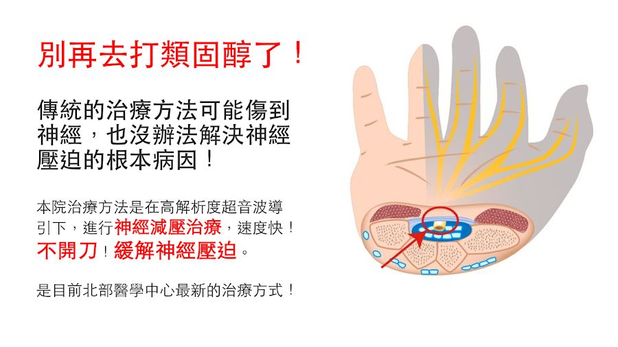 腕隧道症候群與治療方式簡介