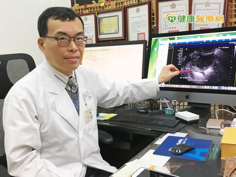 子宮,內膜異位,經痛,卵巢癌,復發率,黃體素,經期,健保給付