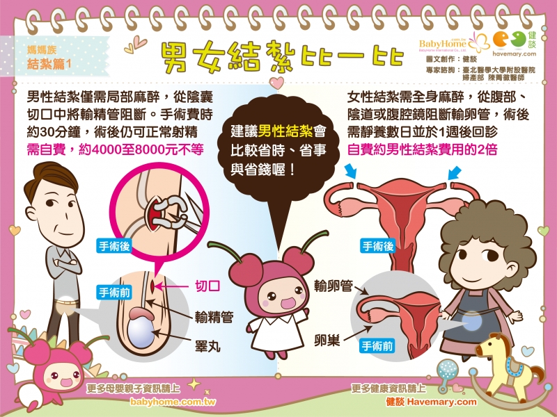 結紮,生育,輸精管,麻醉,風險,輸卵管,更年期,泌尿科,健保給付