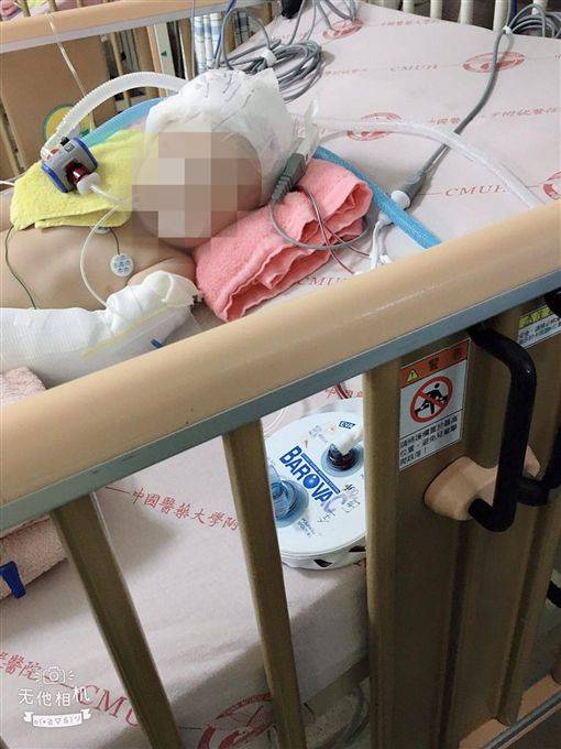 單親爸爸,女兒,保母,顱內出血,臉書,虐待,昏迷
