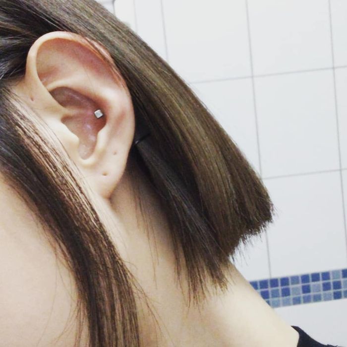 邵雨薇,耳前廔管,感染發炎