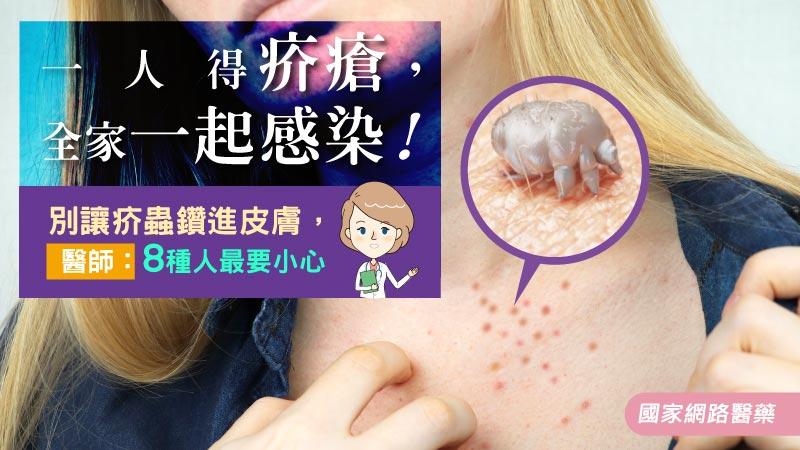 疥瘡,接觸傳染,隔離治療