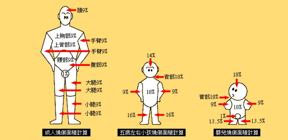 燙傷,燒燙傷,嬰兒燙傷