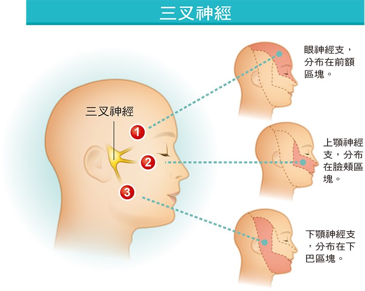 牙痛,蛀牙,拔牙,三叉神經痛,神經痛,腫瘤,台大醫院