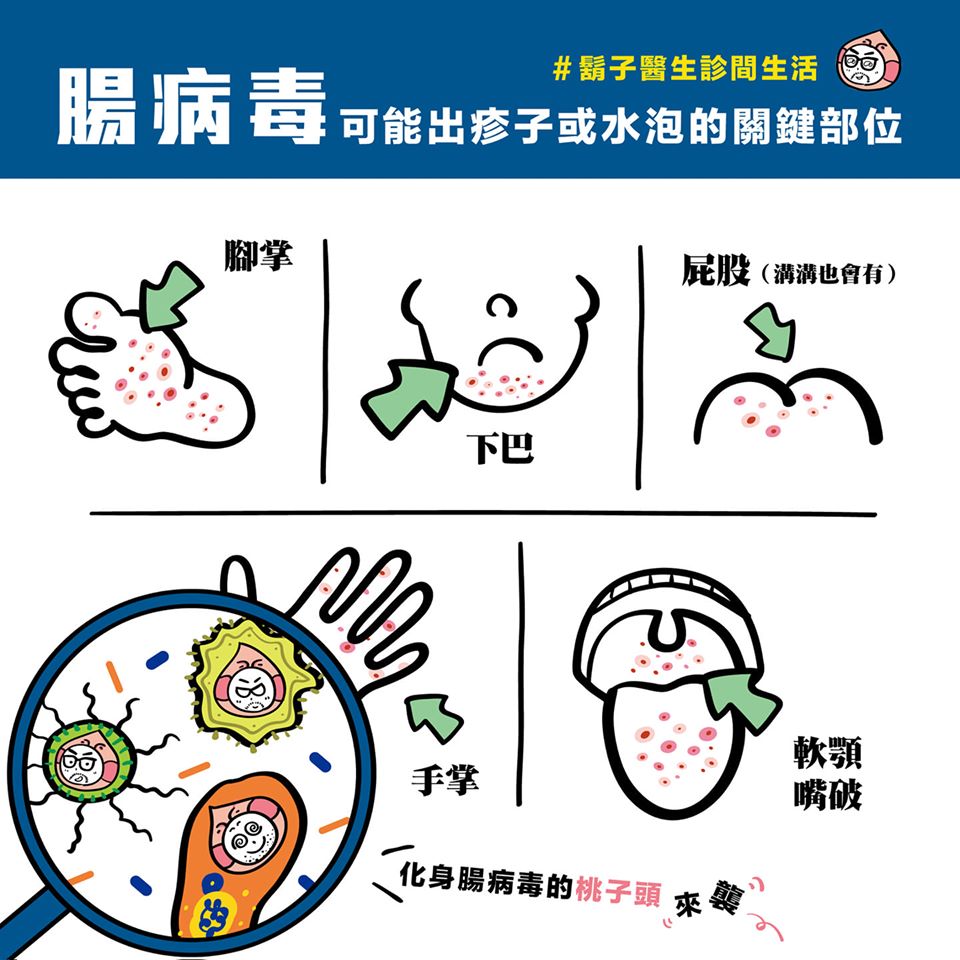 腸病毒,流行病毒