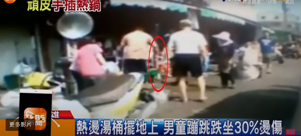 急救,傷口處理,熱痙攣,燙傷,流鼻血,扭傷,湯桶 燙傷,兒童安全