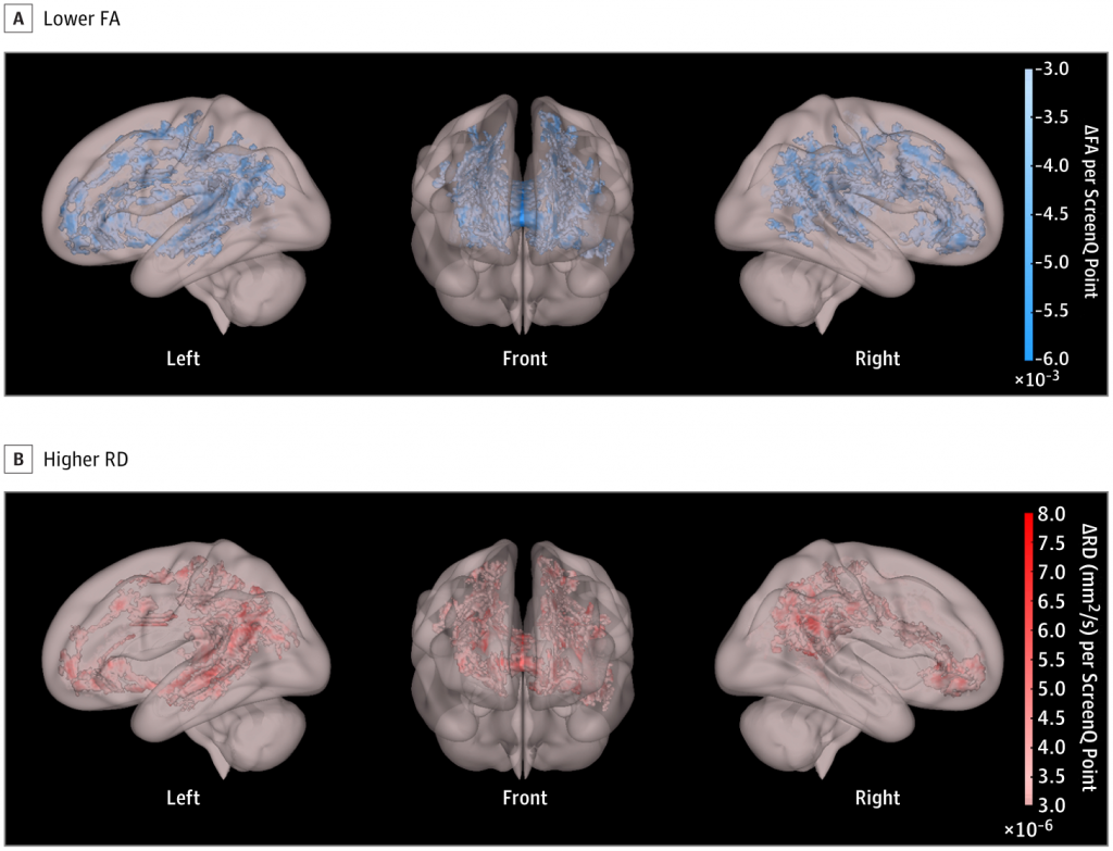 Associations Between Screen-Based Media Use and Brain White Matter Integrity in Preschool-Aged Children