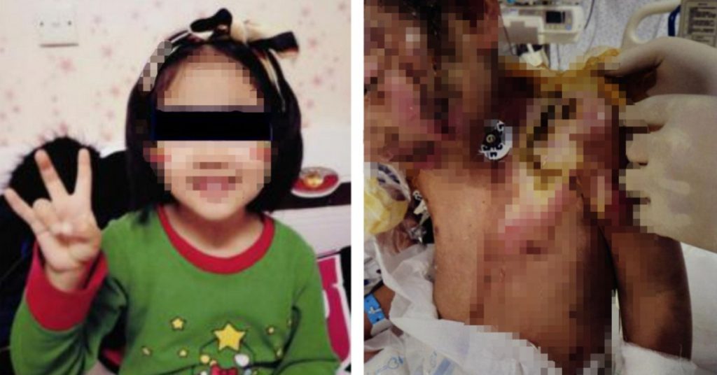 傷害 兒童,同居人 傷害小孩,兒童安全,小孩 心理創傷