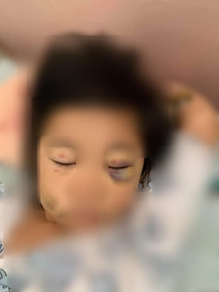 兒童托育,請人帶孩子,小孩托育,請朋友顧小孩,幫忙顧小孩,朋友 顧小孩,傷害兒童
