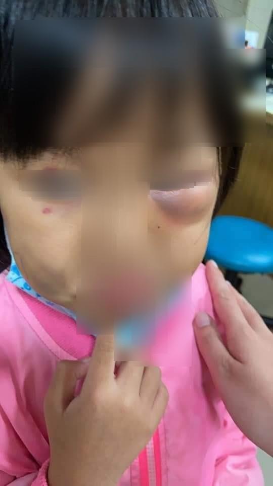 兒童托育,請人帶孩子,小孩托育,請朋友顧小孩,幫忙顧小孩,朋友 顧小孩,傷害兒童
