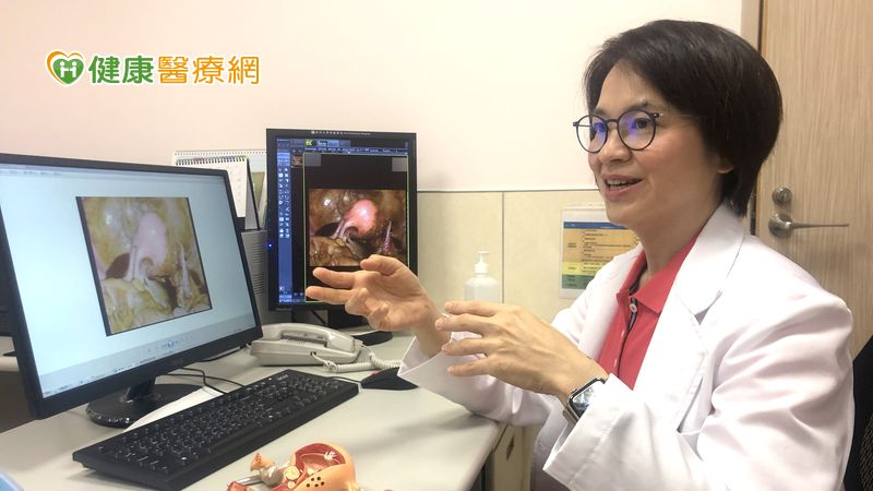 子宮內膜異位症,不孕,經痛,女性疾病,子宮內膜異位